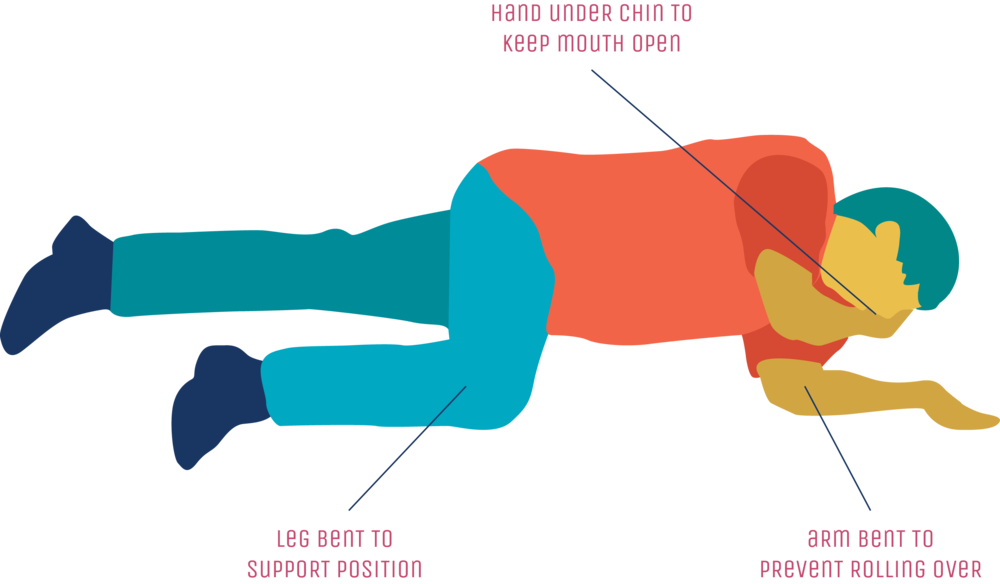 recovery position for intoxicated person -place on side, tilt head to maintain airway, tuck nearest hand to cheek to maintain head tilt 